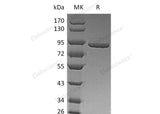 Recombinant Human PFK1/PFKM Protein (His Tag)