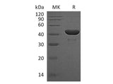 Recombinant Human PGK1/PGKA Protein (His Tag) 