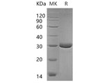 Recombinant Human PMM2 Protein (His Tag) 