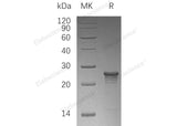 Recombinant Human Phosphomevalonate Kinase/PMVK Protein (His Tag)