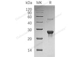 Recombinant Human PPCDC Protein (His Tag)