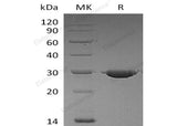 Recombinant Human PSPH Protein (His Tag)