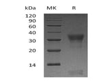 Recombinant Human PIK3IP1 Protein (His Tag) 