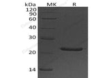 Recombinant Human Placental Lactogen/CSH1 Protein (His Tag)