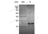 Recombinant Human PDGF-AA Protein (Active)