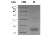 Recombinant Human PDGF-AA Protein (His Tag)(Active)