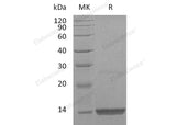 Recombinant Human PDGF-BB Protein (Active)