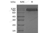 Recombinant Human PDGFRB/CD140b Protein (His Tag)