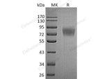 Recombinant Human TEM7/PLXDC1 Protein (His Tag)