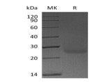 Recombinant Human Podoplanin/PDPN Protein (His Tag)