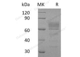 Recombinant Human Podoplanin/PDPN Protein (Fc Tag)