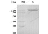 Recombinant Human PIGR Protein (Fc Tag)