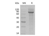 Recombinant Human GALNT3 Protein (His Tag)