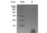 Recombinant Human Polyubiquitin-B/UBB Protein (GST&His Tag)