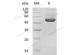 Recombinant Human HMBS Protein (His Tag)