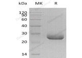 Recombinant Human PRADC1/PAP21 Protein (His Tag)