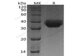 Recombinant Human Protein δ Homolog 1/DLK1 Protein (His Tag)