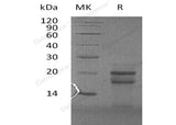 Recombinant Human PFDN4 Protein (His Tag)