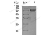 Recombinant Human PSG1 Protein (His Tag)