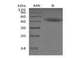 Recombinant Human PSG2 Protein (His Tag)