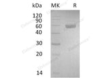 Recombinant Human PSG3 Protein (His Tag)