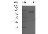 Recombinant Human PSG5 Protein (His Tag)