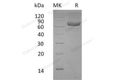 Recombinant Human PSG9/PSBG9 Protein (His Tag)