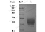 Recombinant Human PRND Protein (His Tag)