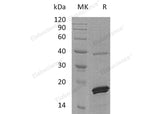 Recombinant Human PRL-2/PTP4A2 Protein (His Tag)