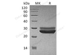 Recombinant Human Prolactin/PRL Protein (His Tag)