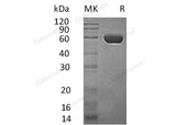 Recombinant Human CPVL/VCP-Like Protein (His Tag)