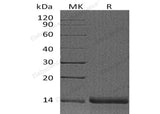 Recombinant Human Profilin-2/PFN2 Protein