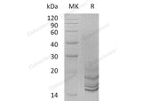 Recombinant Human Progonadoliberin-2/GNRH2 Protein (His Tag)