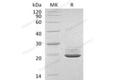 Recombinant Human PRAP1 Protein (His Tag)