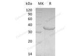 Recombinant Human Pro-Neuregulin-1/NRG1-?β1 Protein (aa 2-246) 