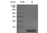 Recombinant Human Pro-Neuregulin-1/NRG1?β1 Protein (aa 177-241)