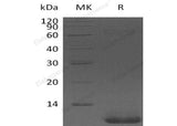 Recombinant Human Pro-Neuregulin-1/NRG1?β1 Protein (aa 176-246)