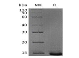 Recombinant Human Pro-Neuropeptide Y/NPY Protein (His Tag)