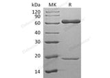 Recombinant Human PCSK9 Protein (His Tag)