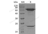 Recombinant Human PCSK9 Protein (His Tag/HA/AVI)