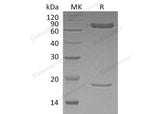 Recombinant Human PCSK9 Protein (AVI Tag)(Active)