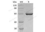 Recombinant Human PCSK9 Protein (D374Y, His Tag)