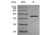 Recombinant Human PSA/KLK3 Protein (aa 18-261, His Tag)