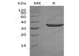 Recombinant Human PSA/KLK3 Protein (aa 25-261, His Tag)