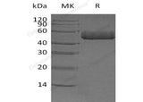 Recombinant Human Prostatic Acid Phosphatase/ACPP Protein (His Tag)