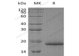 Recombinant Human Protachykinin-1/TAC1 Protein (His Tag)