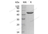 Recombinant Human Protamine-2/PRM2 Protein (His Tag)