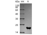 Recombinant Human CUTA Protein (His Tag)