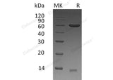 Recombinant Human ERP57/PDIA3 Protein (His Tag)