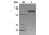 Recombinant Human ERP72/PDIA4 Protein (aa 21-645, His Tag)